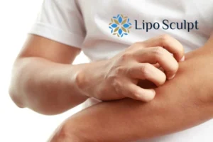 Best Actinic Keratoses Removal 4 prevent your actinic keratoses Leicestershire getting worse - call our team today!