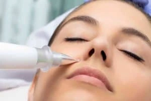 Best Actinic Keratoses Removal 3 Actinic keratoses Leicestershire solutions - book in today!